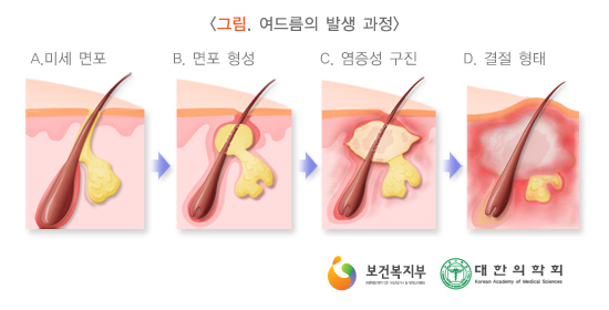 ���帧2.jpg