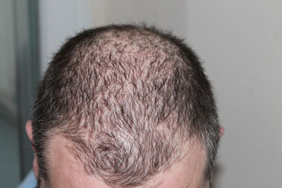 hair-248050_400.jpg