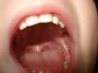 teeth-209860_400.jpg