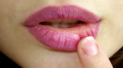 lip-1147365_400.jpg